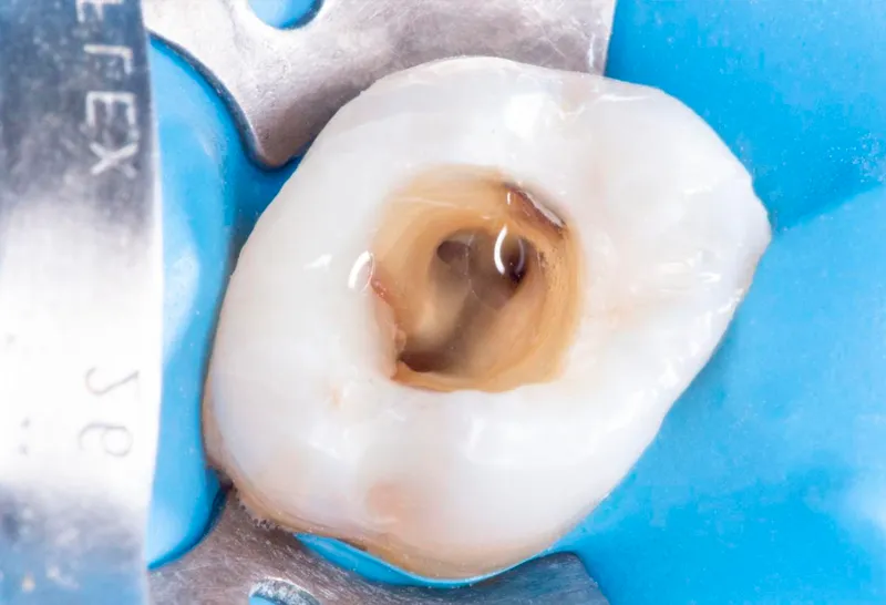 Endodontia